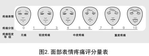 癌症疼痛诊疗规范考试题